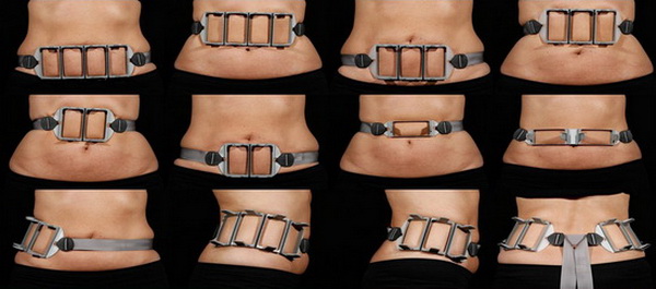 một số cách đặt đầu điều trị của máy giảm béo sculpsure giam beo sculpsure 4.jpg (59 KB)